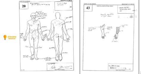 An <b>autopsy</b> report and coroner's drawings of Kobe and <b>Gigi</b> circulate on Twitter. . Gigi autopsy sketch